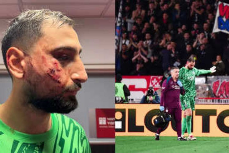 Donnarumma Left Bloodied in PSG's Win as Referee Sparks Controversy